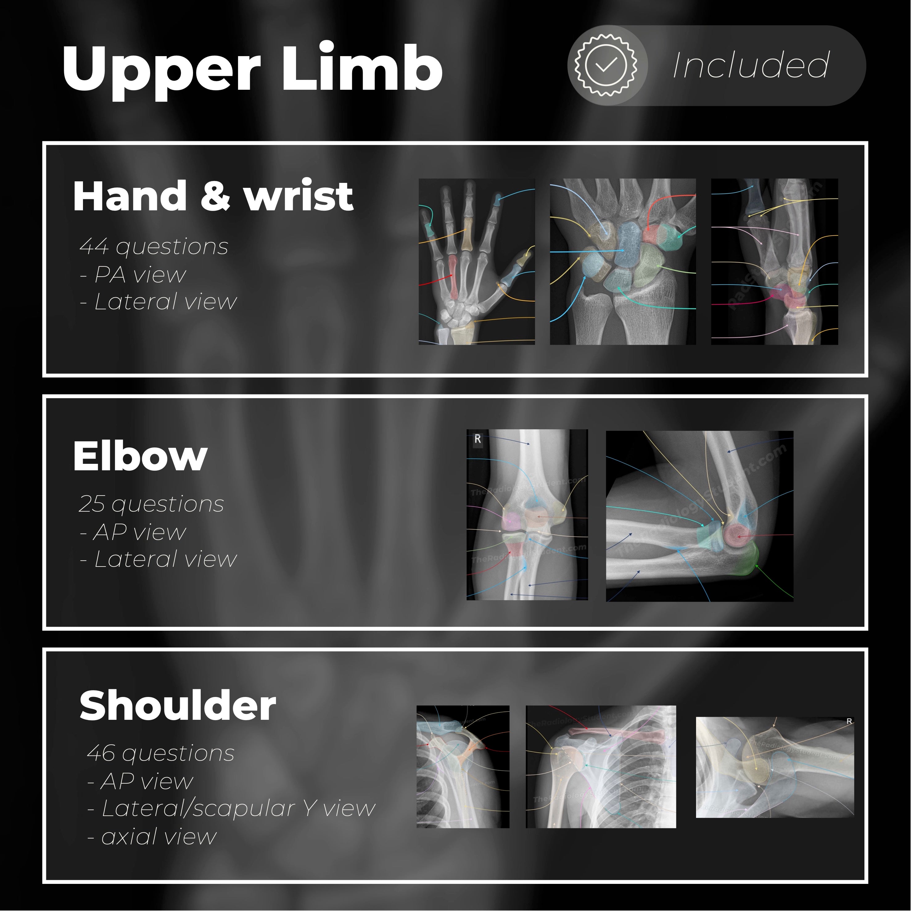 Radiology Anatomy Quiz | Labeled X-ray Notes – TheRadiologyStudent