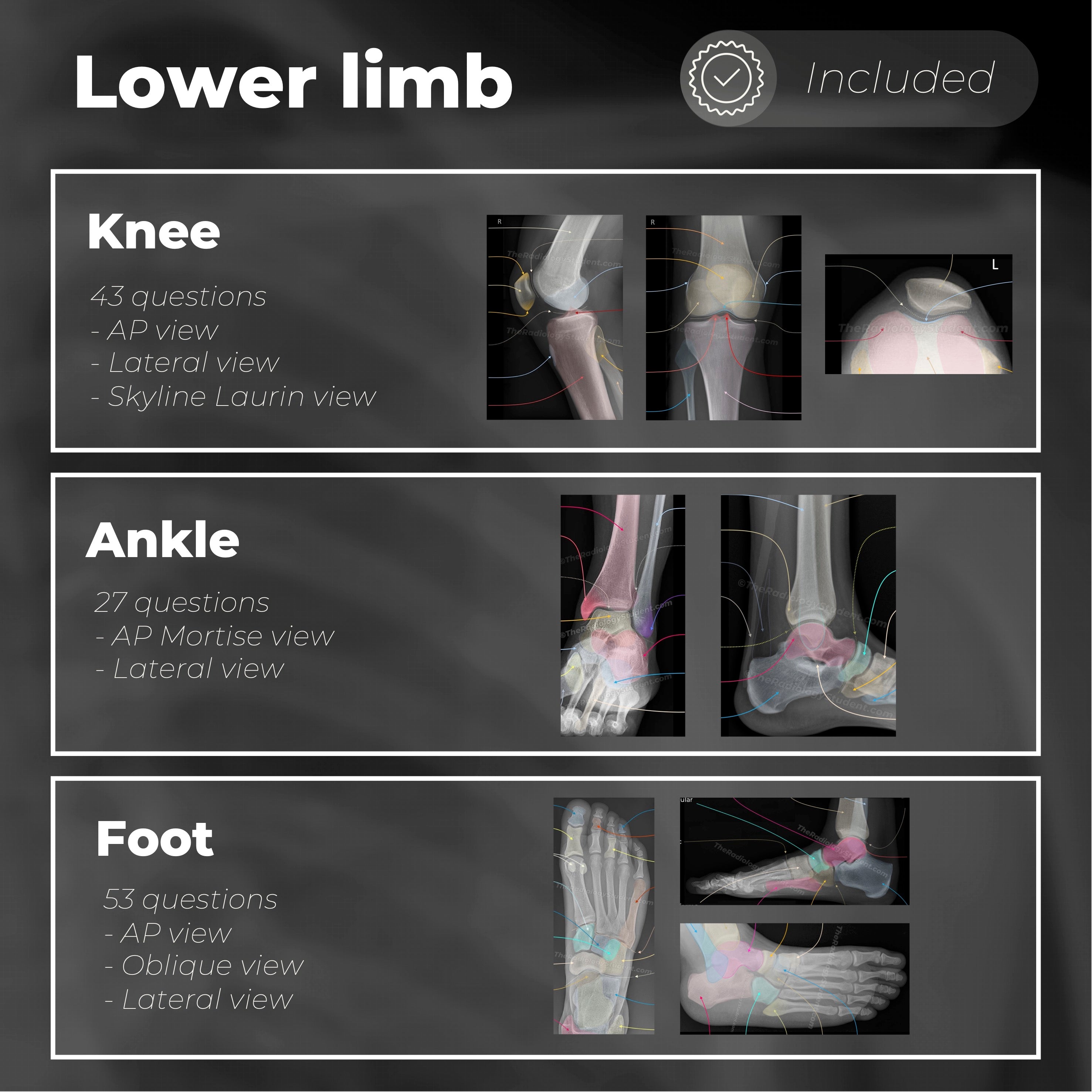 Radiology Anatomy Quiz | Labeled X-ray Notes – TheRadiologyStudent