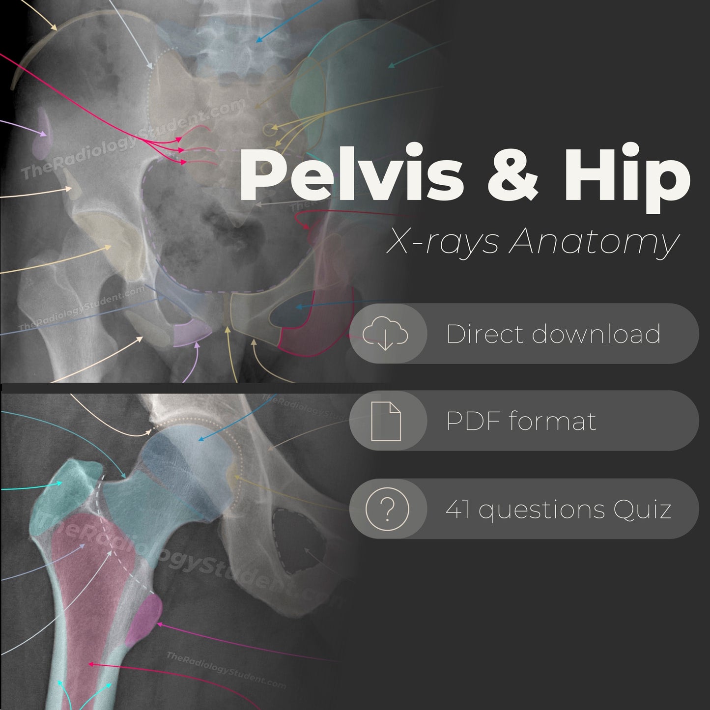 Pelvis and hip xray quiz | Study guide for radiology student