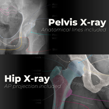 Pelvis and hip xray quiz | Study guide for radiology student