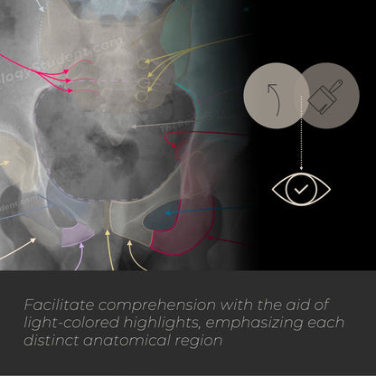 Pelvis and hip xray quiz | Study guide for radiology student