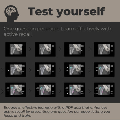 Pelvis and hip xray quiz | Study guide for radiology student