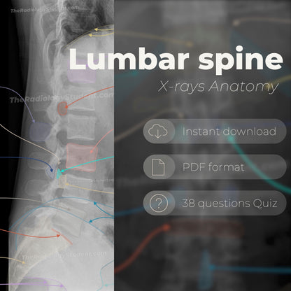 Lumbar spine radiographic anatomy | Annotated x-ray quiz