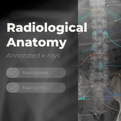 Lumbar spine radiographic anatomy | Annotated x-ray quiz