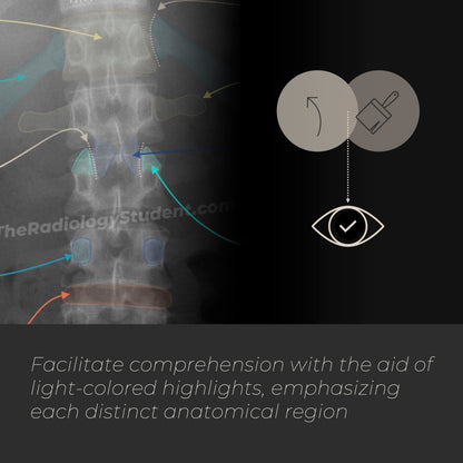 Lumbar spine radiographic anatomy | Annotated x-ray quiz