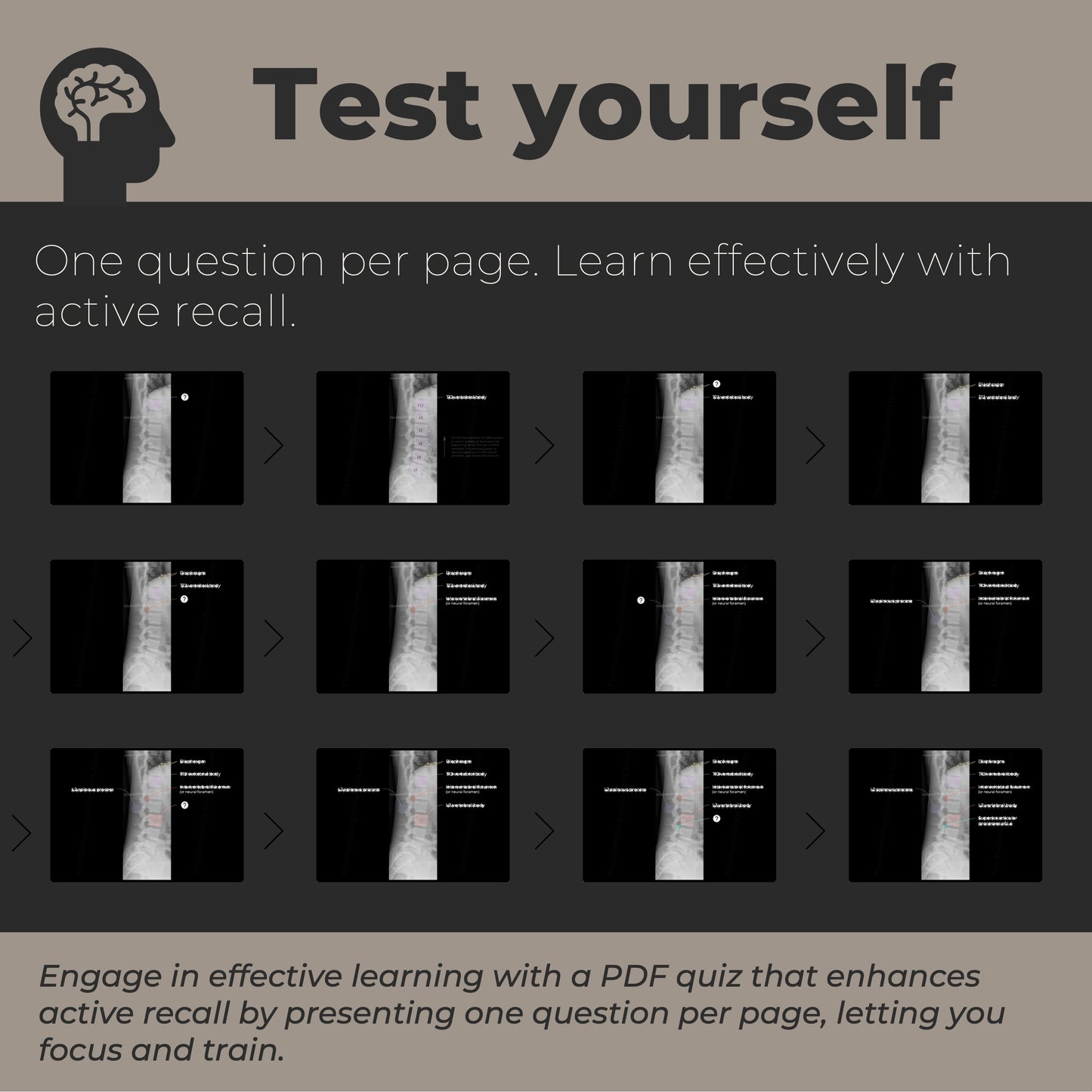 Lumbar spine radiographic anatomy | Annotated x-ray quiz