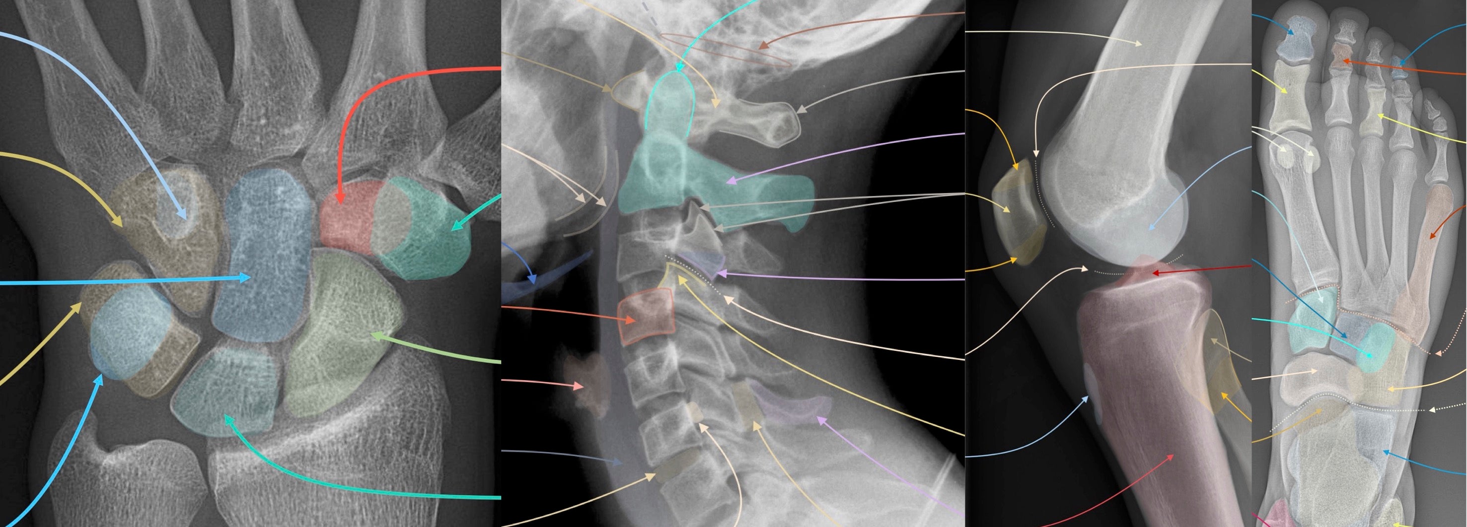 Radiology Anatomy Quiz | Labeled X-ray Notes – TheRadiologyStudent