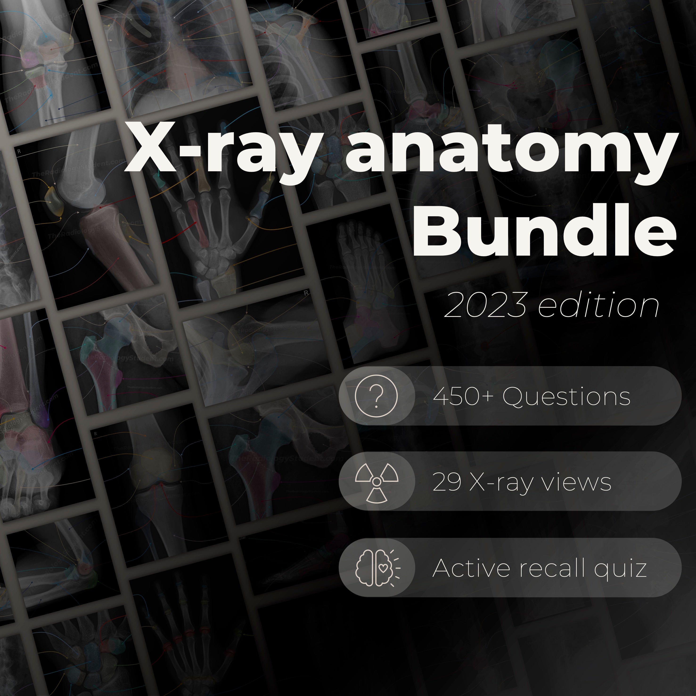 Radiology Anatomy Quiz | Labeled X-ray Notes – TheRadiologyStudent