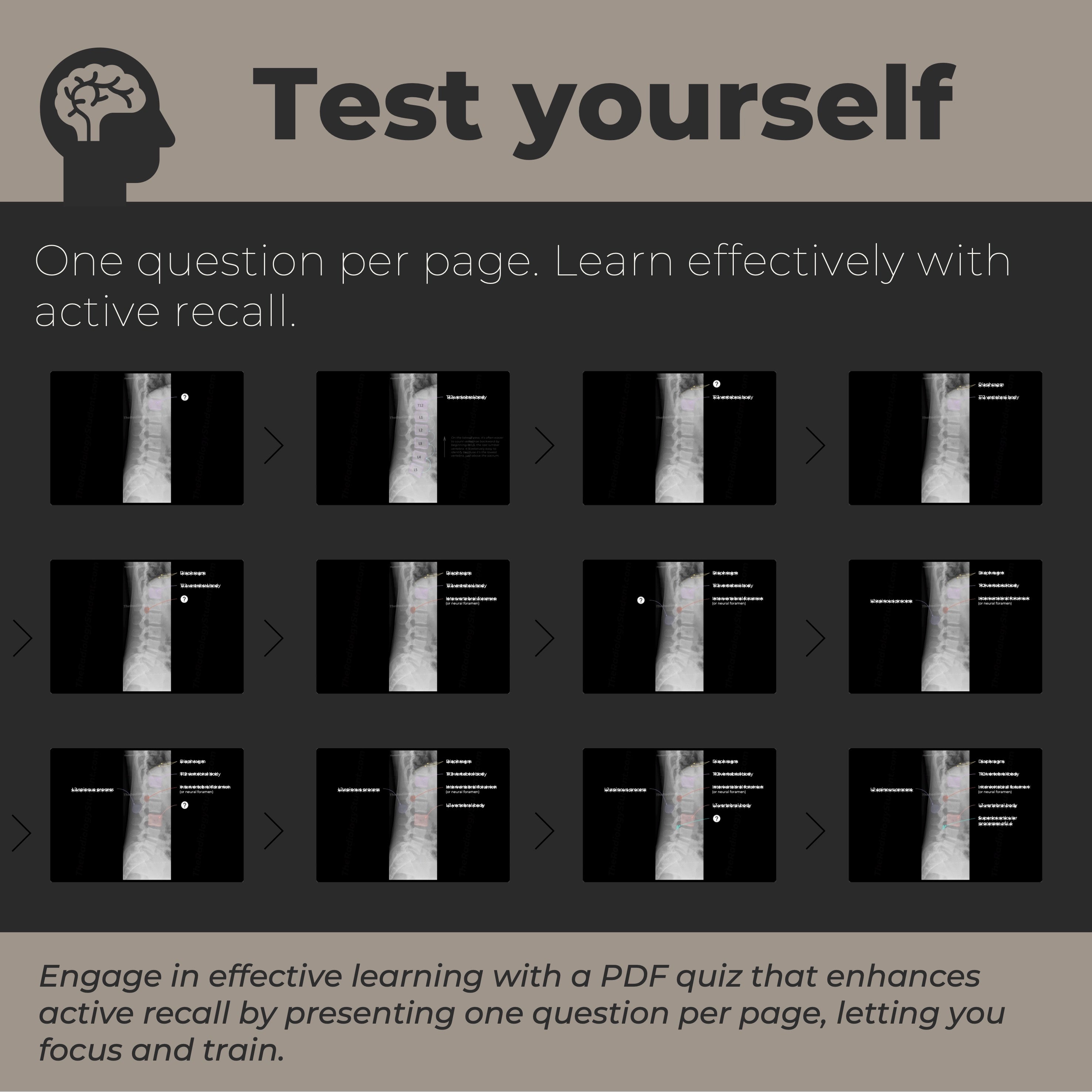 Radiology Anatomy Quiz | Labeled X-ray Notes – TheRadiologyStudent